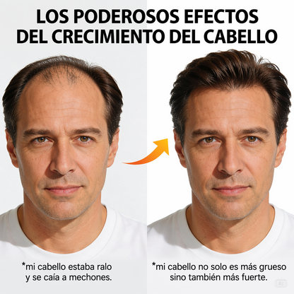 EXCALVO SHAMPOO