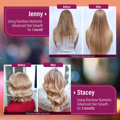 Hair Growth Advanced – Cabello Más Fuerte y Saludable Desde Adentro | 120 Cápsulas
